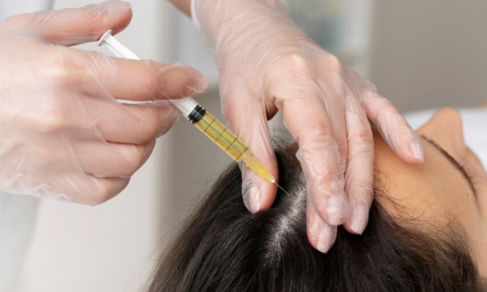 Haartransplantation